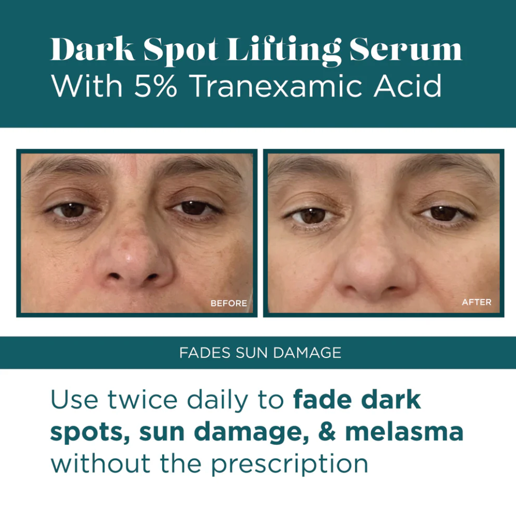 DARK SPOT LIFTING SERUM